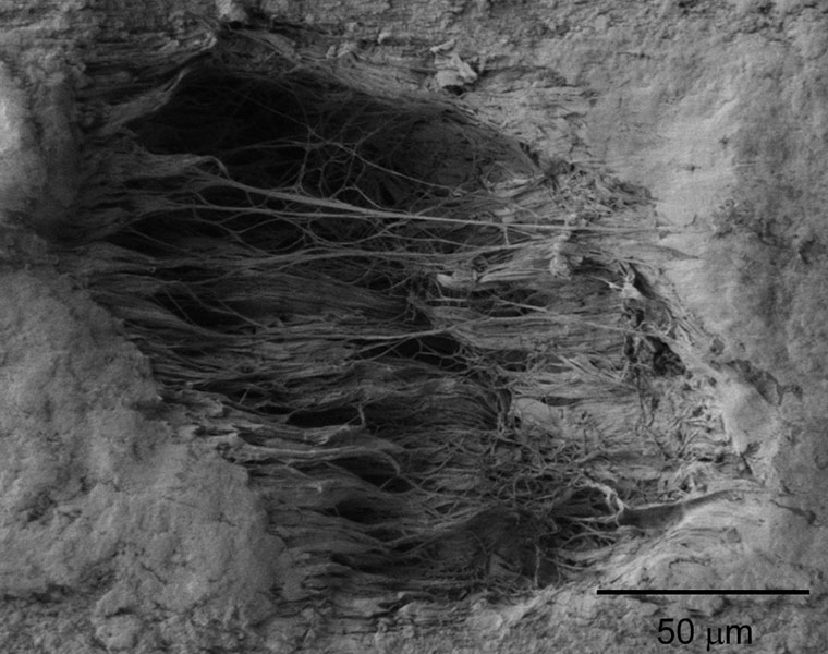 electrostatic charge